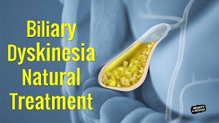 Biliary Dyskinesia Natural Treatment  Biliary Dyskinesia Diet  Gallbladder Diet [upl. by Truc714]