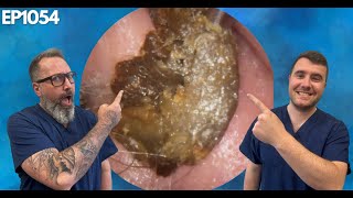 Removing Massive Ear Wax Blockages  EP1054 [upl. by Mosora632]