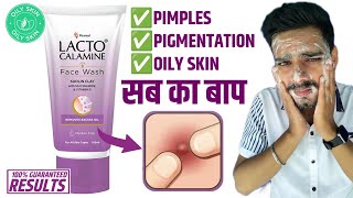 Lacto Calamine Face Wash Genuine Review  Benefits  Side Effects amp Ingredients  For Oily Skin [upl. by Asert]