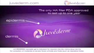 Juvederm  Dermal Filler [upl. by Bebe]