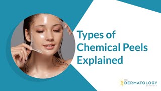 Types of Chemical Peels  Peels for Hyperpigmentation amp Acne [upl. by Enelec]