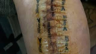 ZIP TIE SUTURES  ZIPSTITCH WOUND CLOSURE WEAK STOMACHS DO NOT WATCH  Angies Life [upl. by Alikat]