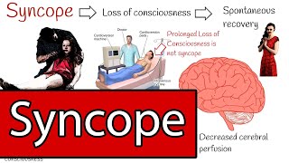 Syncope and Fainting Syncope Types and Treatment Simply explained [upl. by Rizzi]