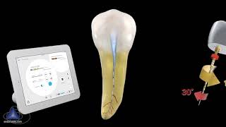 WaveOne® Gold Glider with Dr Cliff Ruddle  Dentsply Sirona [upl. by Desma]