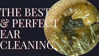 The BEST amp PERFECT Ear Cleaning Satisfying Result At The End [upl. by Twyla955]