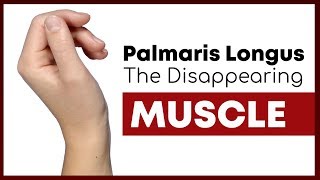 Palmaris Longus The Muscle You Might Not Have  Corporis [upl. by Bary470]