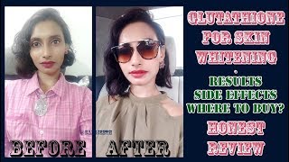 Glutathione Skin Whitening Tablets Results  Genuine Customer Review  SahiJeeth [upl. by Kcirrad]