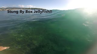 I got Stung By a Box Jellyfish While Surfing [upl. by Dill]