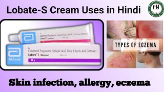 LobateS Cream Uses in Hindi  LobateS benefits  Skin infection  Psoriasis treatment  eczema [upl. by Aklim]