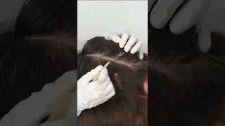 ASMR Detailed Scalp SKIN Examination and Check Up Real Person shorts short asmr [upl. by Philemon]