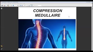 COMPRESSION MÉDULLAIRE [upl. by Elephus615]