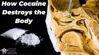 Why Cocaine Is So Incredibly Dangerous [upl. by Leiram]