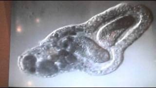 Amoeba eats two paramecia Amoebas lunch [upl. by Jelks329]