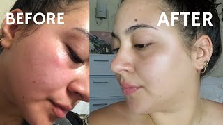 I followed SKINCARE BY HYRAMS product recommendations for 1 week Here are my RESULTS [upl. by Ayerdna]