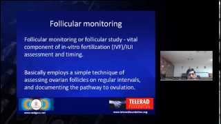 Ultrasound Follicular Study and Monitoring Video by Dr Prasanna [upl. by Auod800]