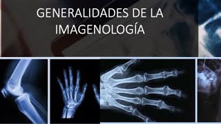 Generalidades de la Imagenología Rx US TAC y RM [upl. by Sacci288]