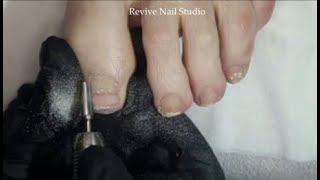 Polygel band removal after curve correction on big toe plus nail shaping and a polish application [upl. by O'Neill]