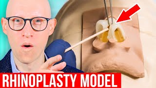 RHINOPLASTY Explained by Plastic Surgeon [upl. by Francisca390]