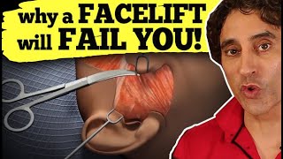 WHY A FACELIFT WILL FAIL YOU  Facelift [upl. by Sarad]