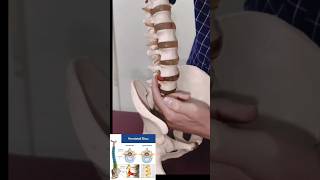 Can a Chiropractor Fix My Sciatica [upl. by Ahsaeit862]