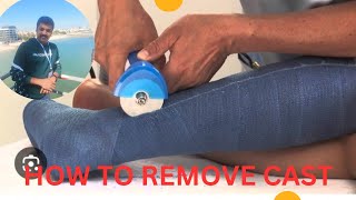 HOW TO REMOVE CAST OR GYPSUM  FIBERCAST  fibercast cast castremovel [upl. by Retep]