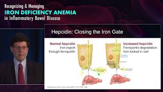 Understanding Iron Deficiency Anemia in Gastroenterology Who and Why [upl. by Ayoj]