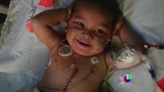 Un niño se recupera de un trasplante de cinco órganos en Miami  Noticiero Univisión [upl. by Kafka]