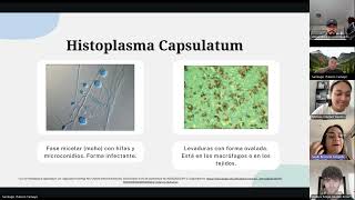 Histoplasmosis Medicina Tropical 20242 [upl. by Aubyn]