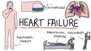 Understanding Heart Failure Visual Explanation for Students [upl. by Celeski]