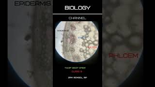 TSof Dicot Stem [upl. by Maxfield]