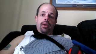 Rotator Cuff Surgery Recovery Post Op  Day 10 after surgery [upl. by Dehlia]