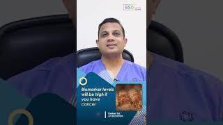 Biomarkers for Ovarian Cancer CA125 Vs HE4 Explained  Ovarian Cancer Diagnosis  Dr Nilesh [upl. by Eiaj164]