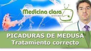 Picadura de medusa  Tratamiento correcto Medicina Clara [upl. by Yatnahs]