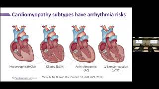 Cardiovascular Genetics from Diagnosis to Therapy [upl. by Anastatius]