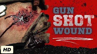 Gunshot Wound Everything You Need To Know [upl. by Thorne]