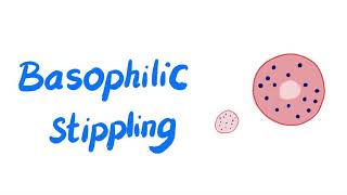 Basophilic Stippling of RBCs  Lead Poisoning  Microscopic Finding  Hematology Labs [upl. by Jeanna881]