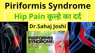 Piriformis Syndrome Homeopathic Medicines for Piriformis Syndrome [upl. by Itsud]