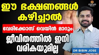 ഈ ഭക്ഷണങ്ങൾ കഴിച്ചു വെരികോസ് വെയ്ൻ പൂർണമായി മാറ്റം Vericose Treatment in Malayalam Dr Bibin Jose [upl. by Eiffe66]