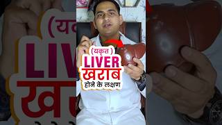 Liver ख़राब होने के क्या क्या लक्षण होते है । Liver cirrhosis  fatty liver viral shorts [upl. by Elbam636]