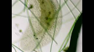 Fat flatworm under microscope [upl. by Yragerg]