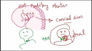 USMLE ACE Video 134 Thyroglossal Duct Cyst vs Branchial Cleft Cyst [upl. by Thibaut]