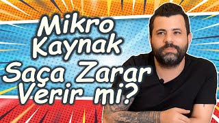 Mikro Kaynak Saça Zarar Verir mi  Toprak Şeker [upl. by Horter37]