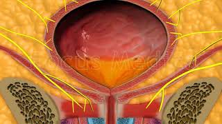 Botulinum toxin injection therapy  Animated Atlas of BPH and OAB [upl. by Ynatsyd637]