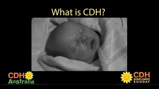 What is CDH [upl. by Annwahsal]