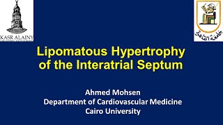 Lipomatous hypertrophy of the Interatrial Septum Lipomatous atrial septal hypertrophy LASH [upl. by Ahsekad302]