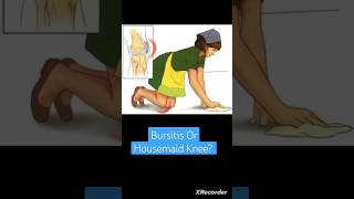 Bursitis Or Housemaid Knee Anatomy Lower Limb [upl. by Odlanar639]