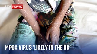 Experts warn deadly mpox virus is quite likely in the UK [upl. by Noleta]