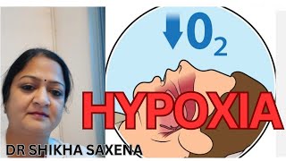 Hypoxic Classification of Hypoxia Telegram httpstmedrshikhasaxenahumanphysiology [upl. by Coralyn364]