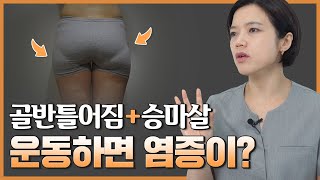 사진확인승마살골반틀어짐다리통증평발 어떤 체형이길래 [upl. by Nyllij]