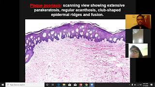 Lecture 4 Dermatopathology Psoriasiform and Spongiotic dermatoses [upl. by Nhar337]